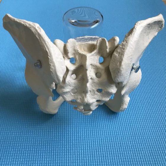 Pelvis tilted back with gaps between sacrum and pelvis